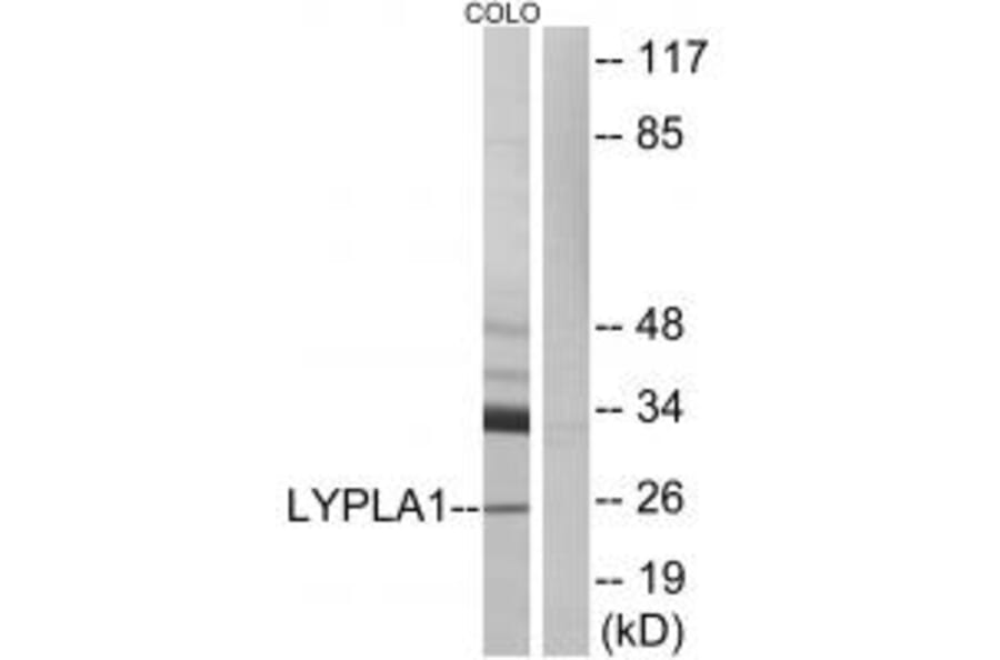 Western blot - LYPLA1 Antibody from Signalway Antibody (34384) - Antibodies.com