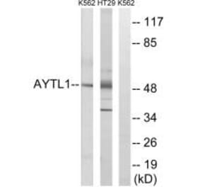 Western blot - LPCAT2 Antibody from Signalway Antibody (34385) - Antibodies.com