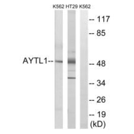 Western blot - LPCAT2 Antibody from Signalway Antibody (34385) - Antibodies.com