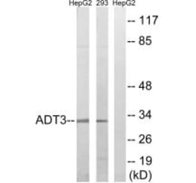Western blot - SLC25A6 Antibody from Signalway Antibody (34388) - Antibodies.com