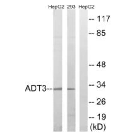 Western blot - SLC25A6 Antibody from Signalway Antibody (34388) - Antibodies.com