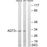 Western blot - SLC25A6 Antibody from Signalway Antibody (34388) - Antibodies.com