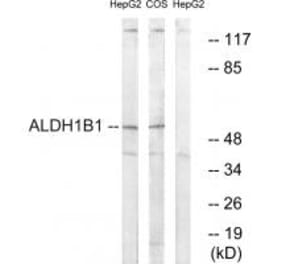 Western blot - ALDH1B1 Antibody from Signalway Antibody (34398) - Antibodies.com