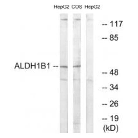 Western blot - ALDH1B1 Antibody from Signalway Antibody (34398) - Antibodies.com