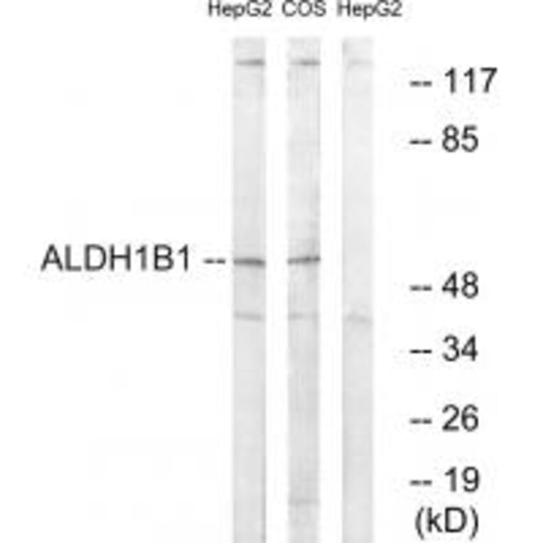 Western blot - ALDH1B1 Antibody from Signalway Antibody (34398) - Antibodies.com