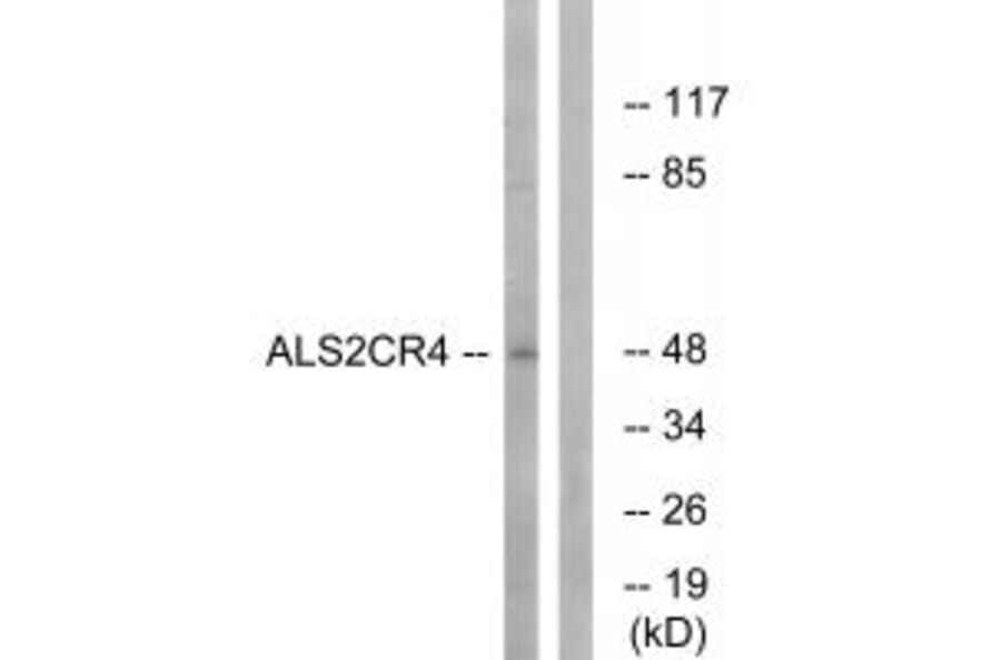 Western blot - ALS2CR4 Antibody from Signalway Antibody (34417) - Antibodies.com