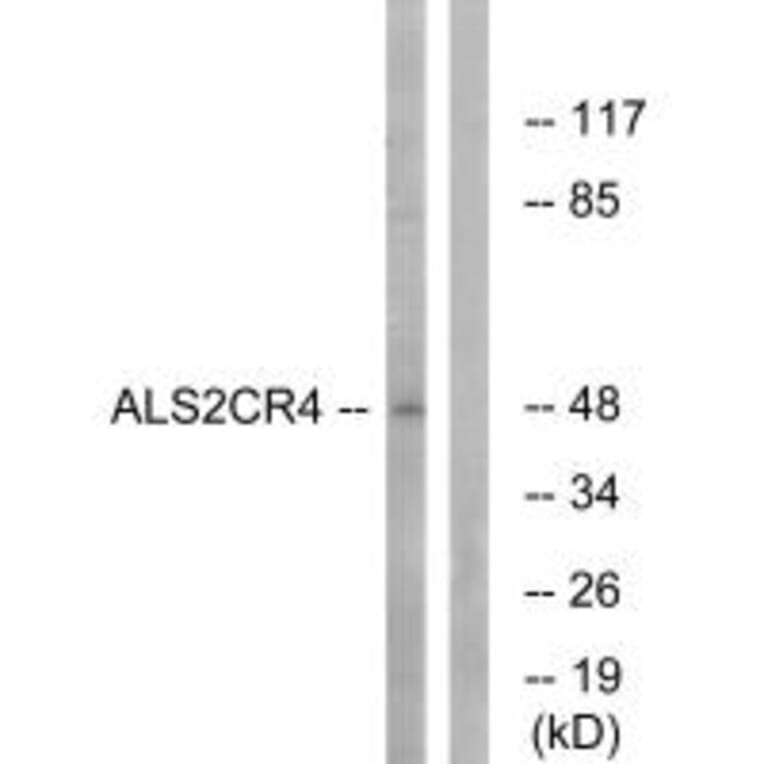Western blot - ALS2CR4 Antibody from Signalway Antibody (34417) - Antibodies.com
