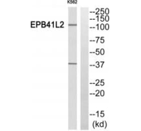 Western blot - EPB41L2 Antibody from Signalway Antibody (34478) - Antibodies.com