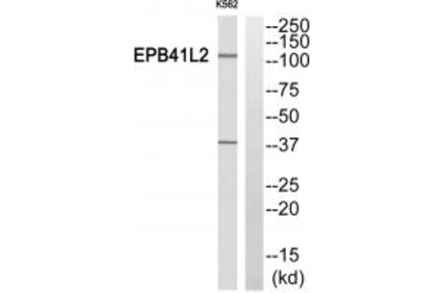 Western blot - EPB41L2 Antibody from Signalway Antibody (34478) - Antibodies.com