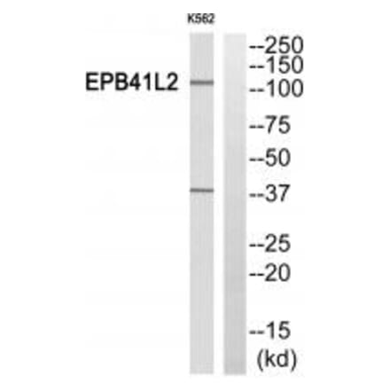 Western blot - EPB41L2 Antibody from Signalway Antibody (34478) - Antibodies.com