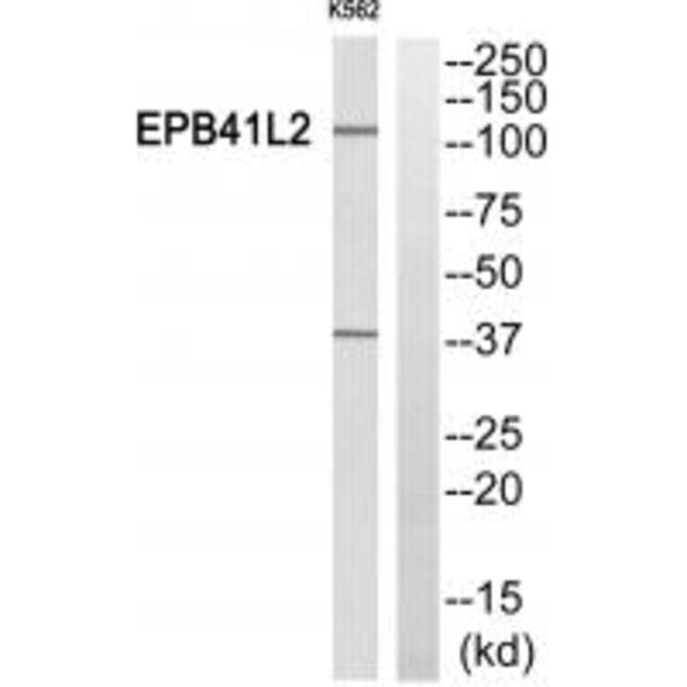 Western blot - EPB41L2 Antibody from Signalway Antibody (34478) - Antibodies.com