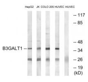 Western blot - B3GALT1 Antibody from Signalway Antibody (34486) - Antibodies.com