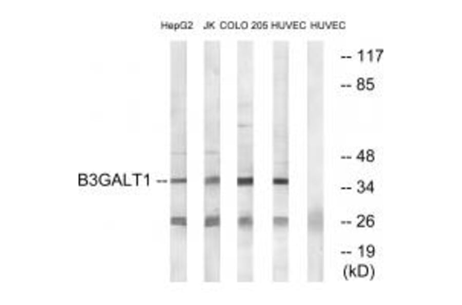 Western blot - B3GALT1 Antibody from Signalway Antibody (34486) - Antibodies.com