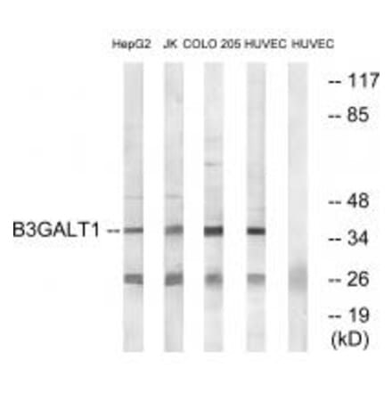 Western blot - B3GALT1 Antibody from Signalway Antibody (34486) - Antibodies.com