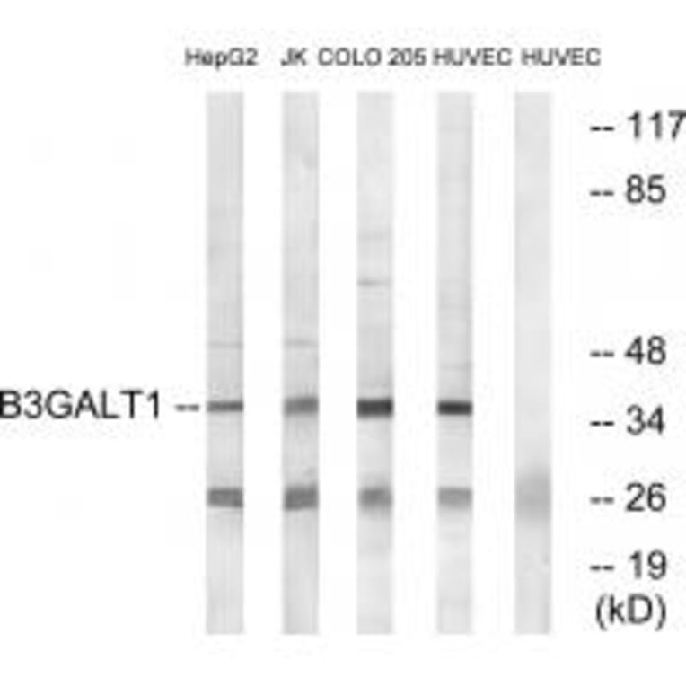 Western blot - B3GALT1 Antibody from Signalway Antibody (34486) - Antibodies.com