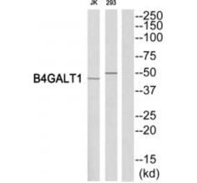 Western blot - B4GALT1 Antibody from Signalway Antibody (34492) - Antibodies.com