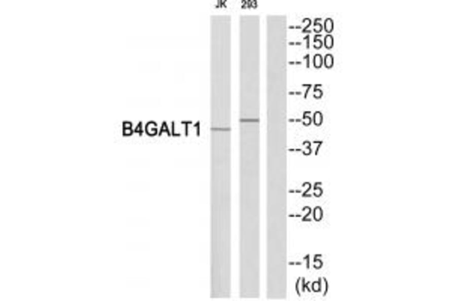 Western blot - B4GALT1 Antibody from Signalway Antibody (34492) - Antibodies.com
