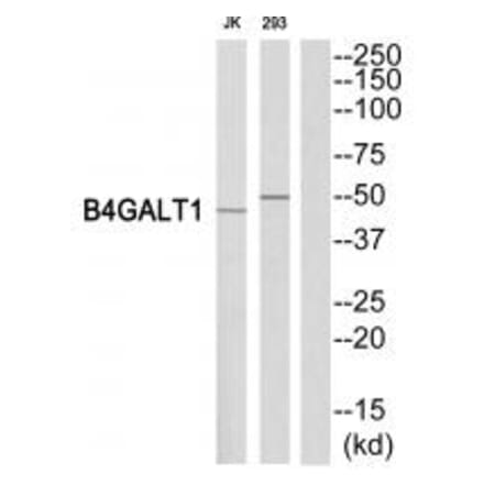 Western blot - B4GALT1 Antibody from Signalway Antibody (34492) - Antibodies.com