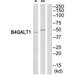 Western blot - B4GALT1 Antibody from Signalway Antibody (34492) - Antibodies.com