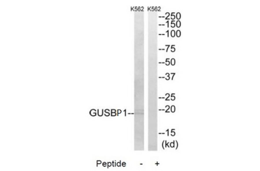 Western blot - GUSBP1 Antibody from Signalway Antibody (34497) - Antibodies.com