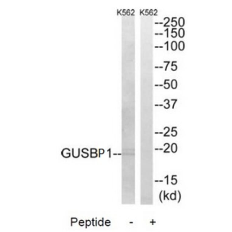 Western blot - GUSBP1 Antibody from Signalway Antibody (34497) - Antibodies.com
