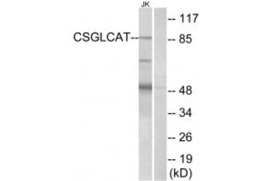 Western blot - CSGLCAT Antibody from Signalway Antibody (34586) - Antibodies.com