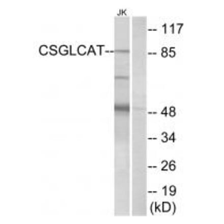 Western blot - CSGLCAT Antibody from Signalway Antibody (34586) - Antibodies.com
