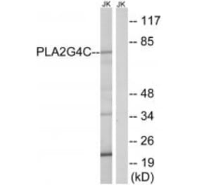 Western blot - PLA2G4C Antibody from Signalway Antibody (34640) - Antibodies.com