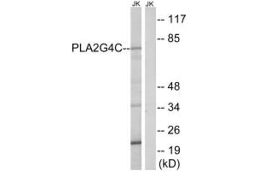 Western blot - PLA2G4C Antibody from Signalway Antibody (34640) - Antibodies.com