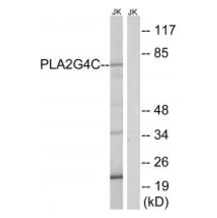 Western blot - PLA2G4C Antibody from Signalway Antibody (34640) - Antibodies.com