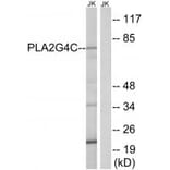 Western blot - PLA2G4C Antibody from Signalway Antibody (34640) - Antibodies.com