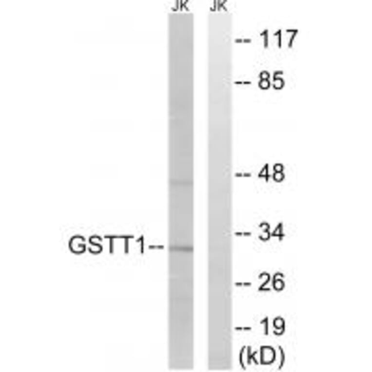 Western blot - GSTT1/4 Antibody from Signalway Antibody (34704) - Antibodies.com
