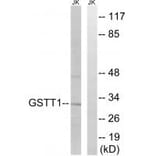 Western blot - GSTT1/4 Antibody from Signalway Antibody (34704) - Antibodies.com