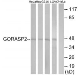 Western blot - GORASP2 Antibody from Signalway Antibody (34706) - Antibodies.com