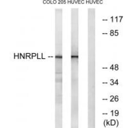 Western blot - HNRPLL Antibody from Signalway Antibody (34733) - Antibodies.com