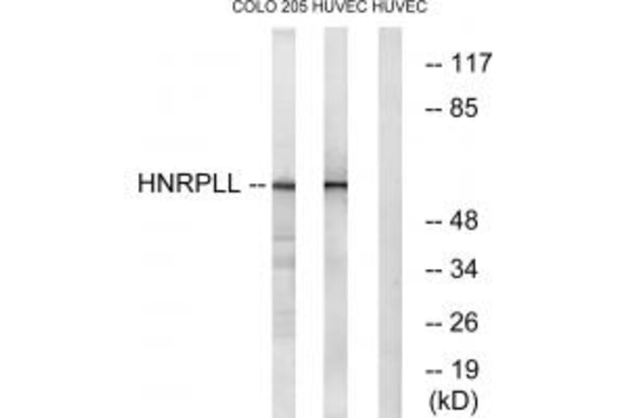Western blot - HNRPLL Antibody from Signalway Antibody (34733) - Antibodies.com