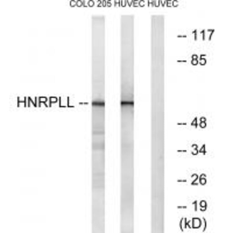 Western blot - HNRPLL Antibody from Signalway Antibody (34733) - Antibodies.com