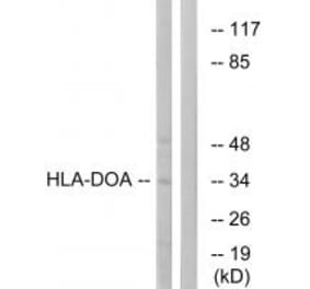 Western blot - HLA-DOA Antibody from Signalway Antibody (34735) - Antibodies.com