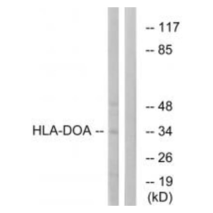 Western blot - HLA-DOA Antibody from Signalway Antibody (34735) - Antibodies.com