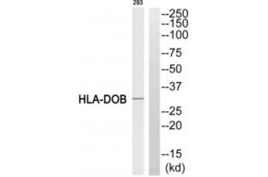 Western blot - HLA-DOB Antibody from Signalway Antibody (34736) - Antibodies.com