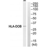 Western blot - HLA-DOB Antibody from Signalway Antibody (34736) - Antibodies.com