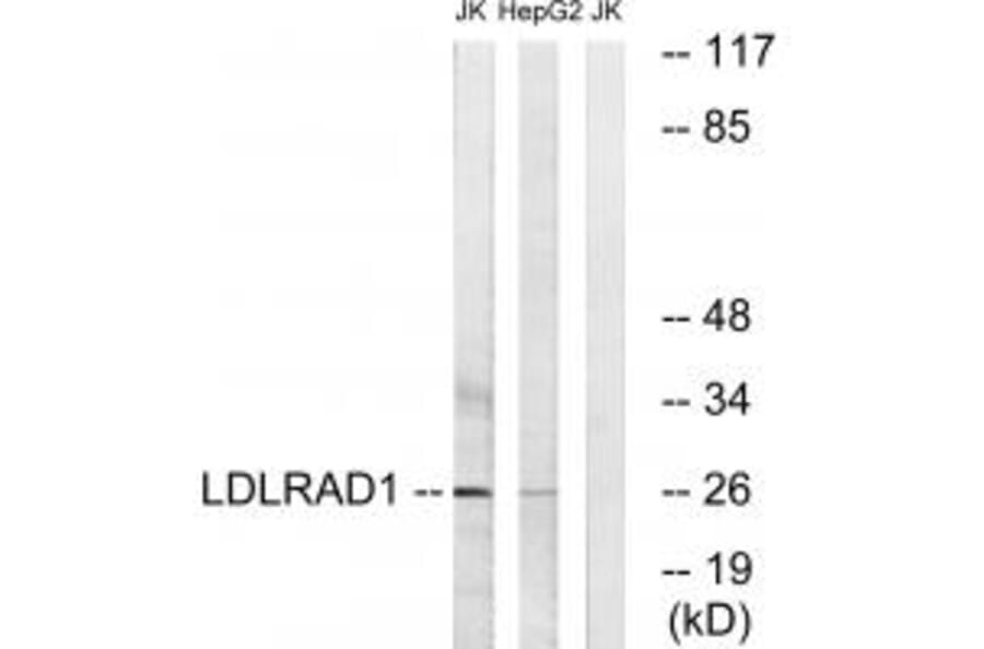Western blot - LDLRAD1 Antibody from Signalway Antibody (34763) - Antibodies.com