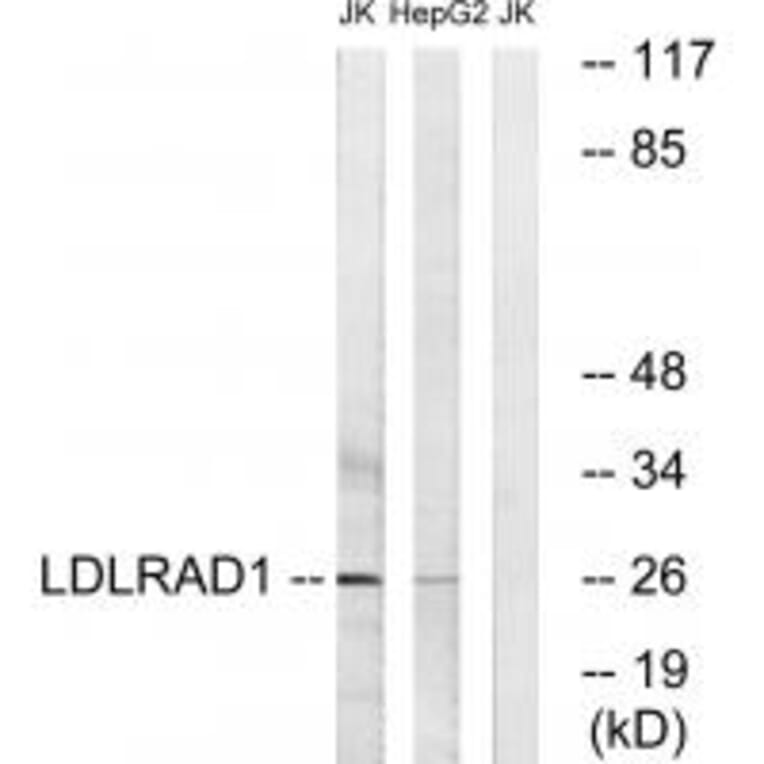 Western blot - LDLRAD1 Antibody from Signalway Antibody (34763) - Antibodies.com