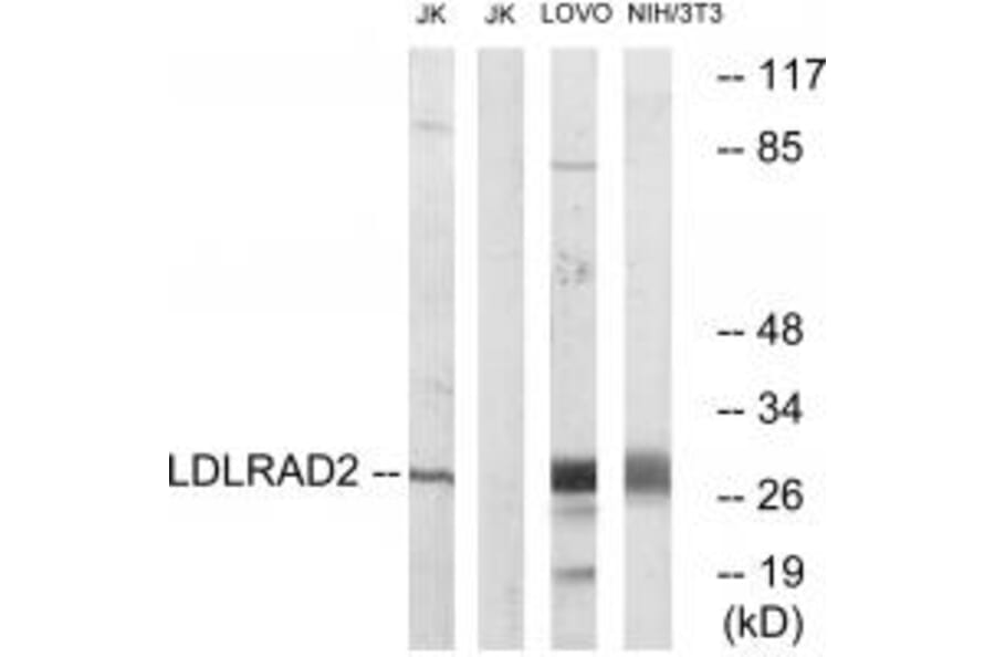 Western blot - LDLRAD2 Antibody from Signalway Antibody (34764) - Antibodies.com