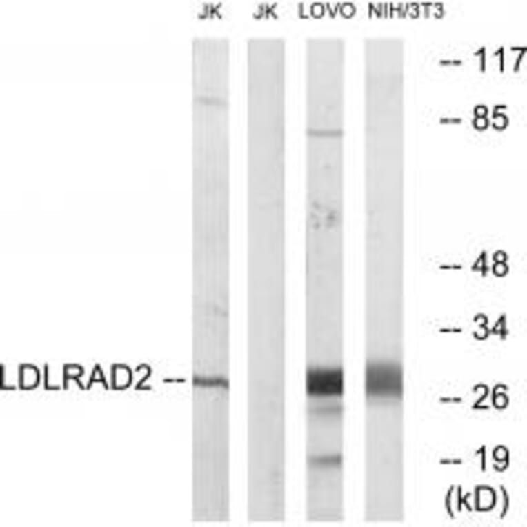 Western blot - LDLRAD2 Antibody from Signalway Antibody (34764) - Antibodies.com