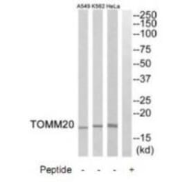 Western blot - TOMM20 Antibody from Signalway Antibody (34806) - Antibodies.com