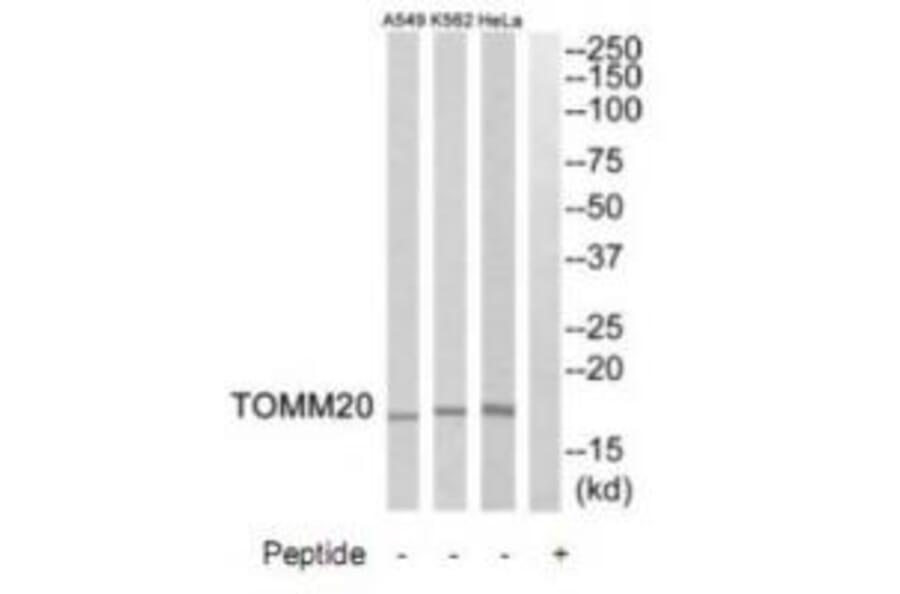 Western blot - TOMM20 Antibody from Signalway Antibody (34806) - Antibodies.com
