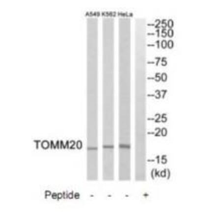 Western blot - TOMM20 Antibody from Signalway Antibody (34806) - Antibodies.com