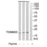 Western blot - TOMM20 Antibody from Signalway Antibody (34806) - Antibodies.com