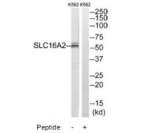 Western blot - SLC16A2 Antibody from Signalway Antibody (34808) - Antibodies.com